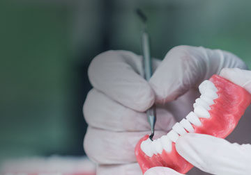 dental-crowns-2